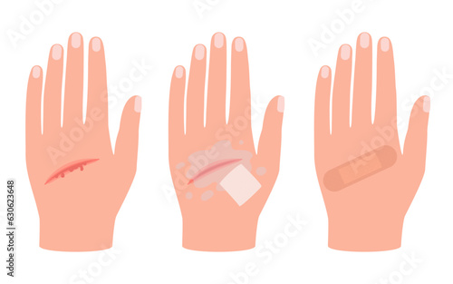 Wound of hand human skin, scratch. First aid for cut injury skin, bleeding cut. Clean and disinfection wound, patch for safe health. Vector