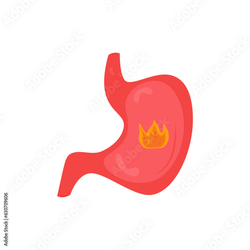 Heartburn in the stomach, food gastritis, diseases of the gastrointestinal tract. Fire in the stomach on a white background.
Flat vector illustration eps 10.