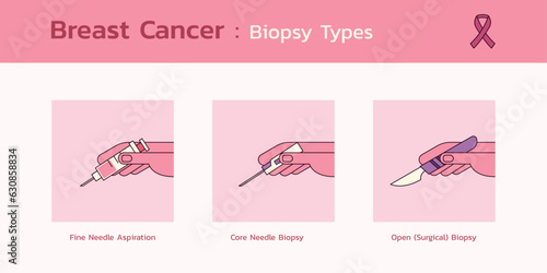 Breast Cancer Diagnosis Infographic, Navigating Biopsy Options for Early Detection and Informed Decisions Awareness, Vector Flat Design Medical Illustration