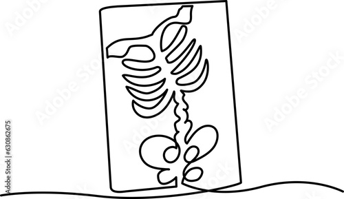Chest x-ray icon. A simple line drawing of the bones of the thorax on an X-ray. Isolated vector on white background.
