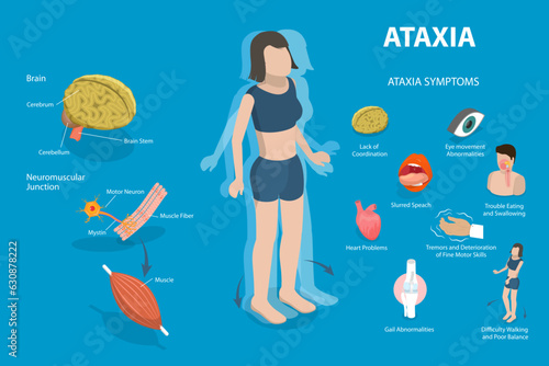 3D Isometric Flat Vector Conceptual Illustration of Ataxia, Educational Medical Diagram photo