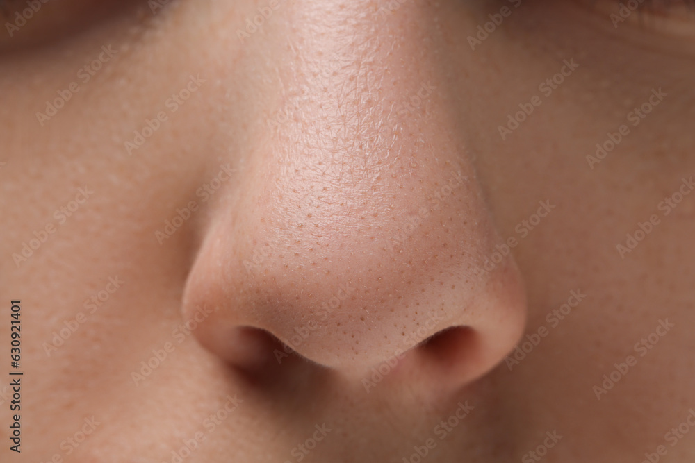 Young woman with acne problem, closeup view of nose Young woman with acne problem, closeup view of nose