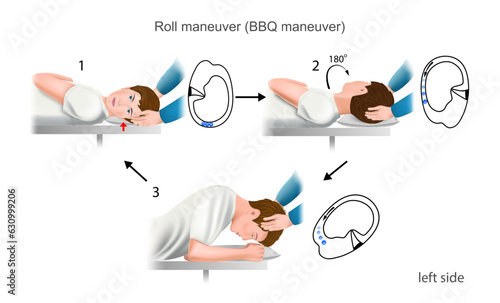 Roll maneuver left side