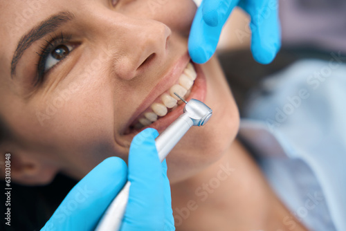 Close-up dentist in protective gloves using dental drill to remove tooth decay