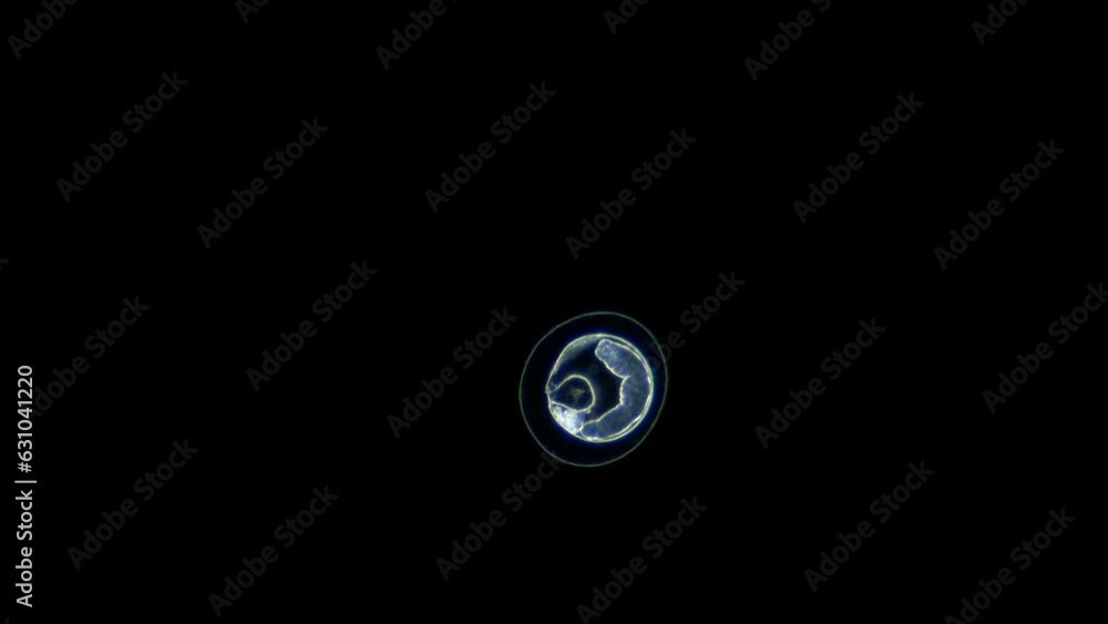 Cyst or capsule of parasitic worm circaria Lecithaster salmonis under a microscope, class Trematoda. You can see how tube shoots and pushes parasite. White Sea Cyst or capsule of parasitic worm circaria Lecithaster salmonis under a microscope, class Trematoda. You can see how tube shoots and pushes parasite. White Sea