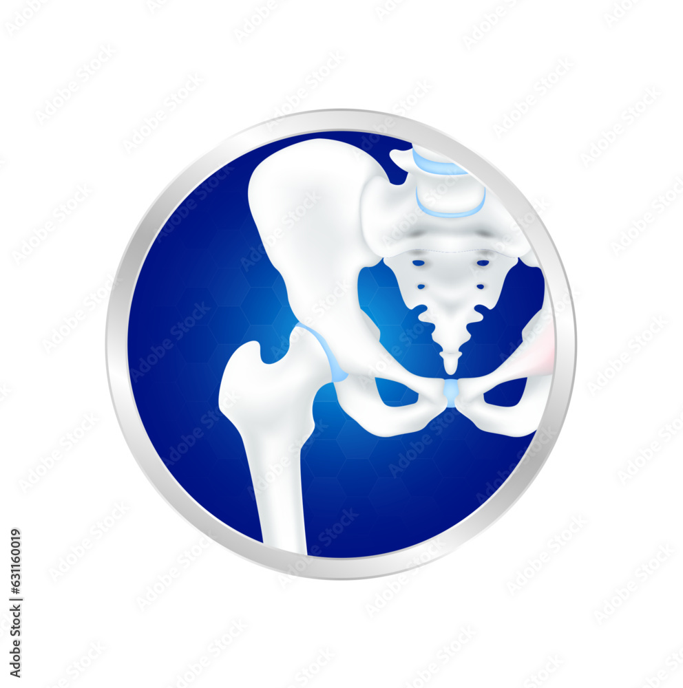 Hip Bone, Pelvis And Joint In Circle Label Aluminum. Cartilage Healthy 