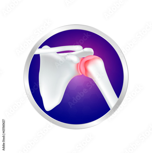 Shoulder bone pain and joint arthritis cartilage in circle label aluminum. Human skeleton anatomy. Foods logo products template design. Medical food supplement concepts. Vector EPS10.