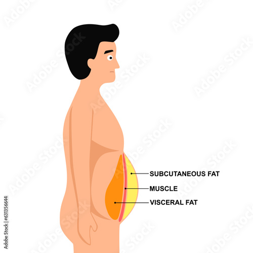 Human abdomen fat layer. Visceral fat in belly concept.