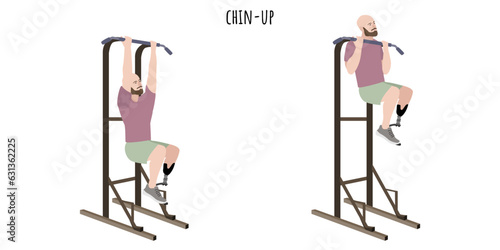 Man with a prosthetic leg doing chin-up exercise