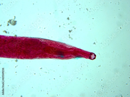 parasite by microscope in a laboratory