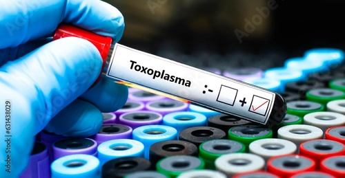 Blood sample of patient positive test for toxoplasma. photo