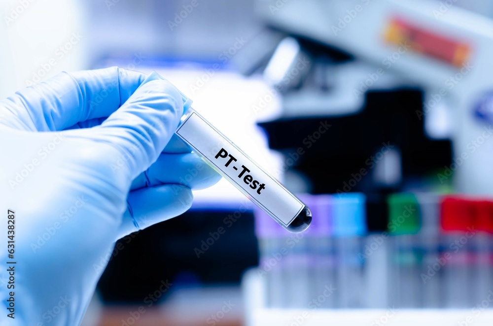 Blood sampling tube for prothrombin time analysis. Blood sampling tube for prothrombin time analysis.