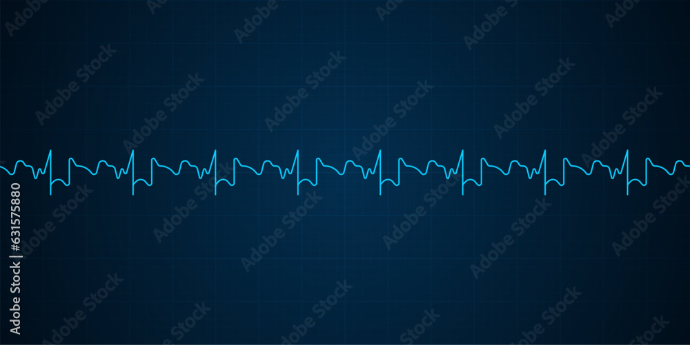 Emergency ekg monitoring. Blue glowing neon heart pulse. Heart beat. Electrocardiogram