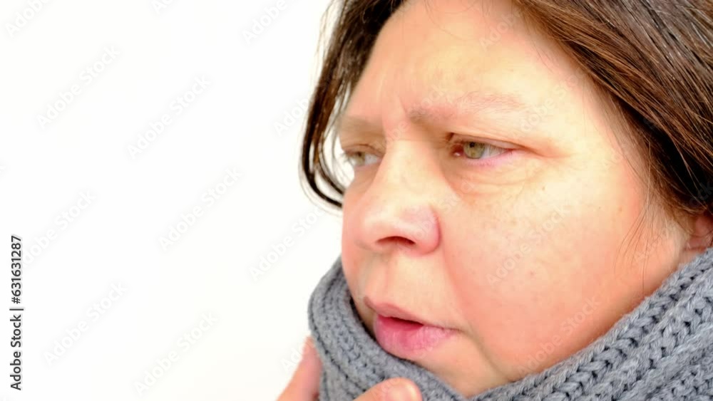 closeup of elderly woman 55 years face, sick person with inflamed eyes