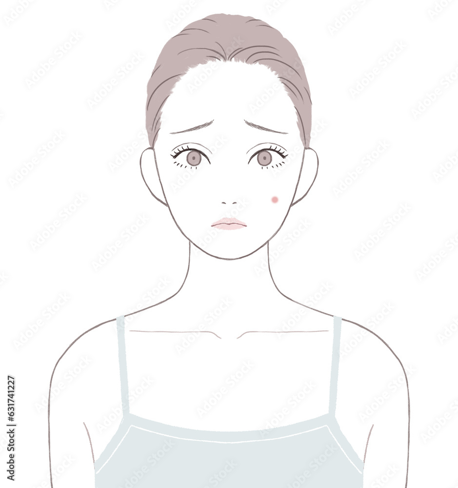 頬のニキビに悩む女性