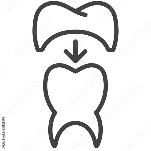 tooth crowning line