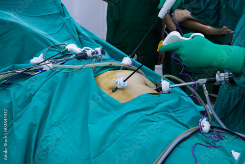 Surgeon perform laparoscopic cholecystectomy