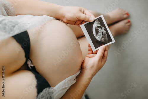 Young pregnant woman with the belly and babys ultrasound paper in hand, pregnancy concept