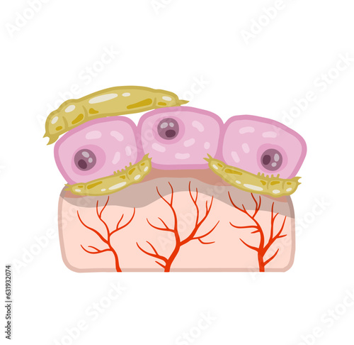Subcutaneous tick. Skin parasite. Beetles on human epidermis. Harmful insects are carriers of disease demodecosis. Flat cartoon illustration
