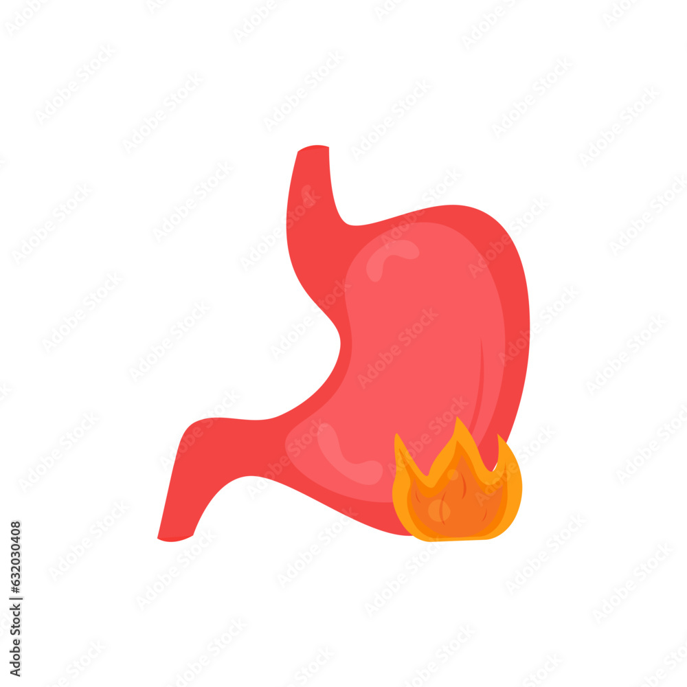 Heartburn in the stomach, food gastritis, diseases of the gastrointestinal tract, indigestion and pain. Fire with a stomach on a white background. Flat vector illustration eps 10. Heartburn in the stomach, food gastritis, diseases of the gastrointestinal tract, indigestion and pain. Fire with a stomach on a white background. Flat vector illustration eps 10.