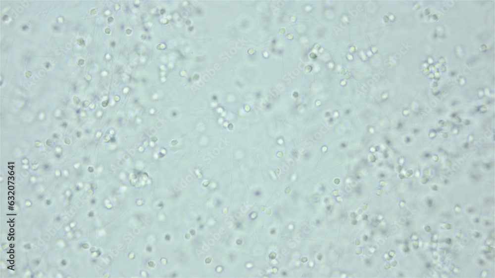 Sperm of worm Polychaeta Ophelia limacina under microscope, Opheliidae family. You can see movement of spermatozoa, head and long tail. White sea Sperm of worm Polychaeta Ophelia limacina under microscope, Opheliidae family. You can see movement of spermatozoa, head and long tail. White sea
