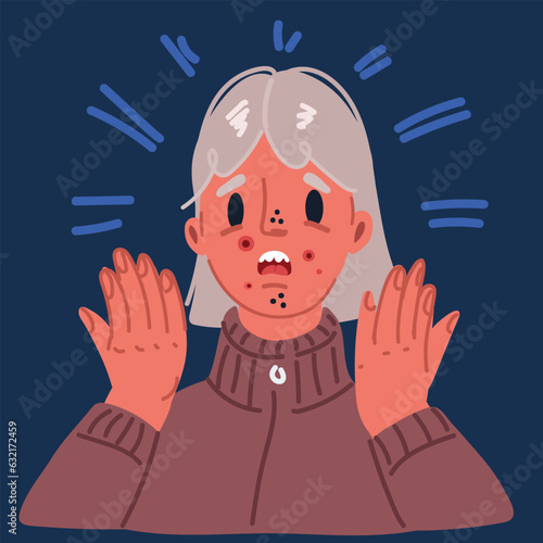 Cartoon vector illustration of Girl wih Problem face skin with acne