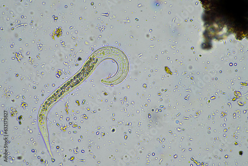 bacterial feeding soil nematode in a soil sample under the microscope photo