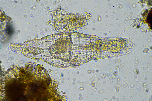 rotifer in a soil sample