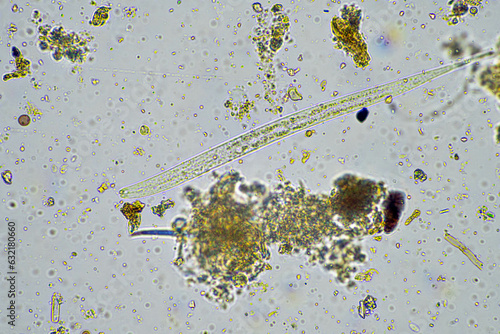 living soil life in a soil sample under the microscope photo