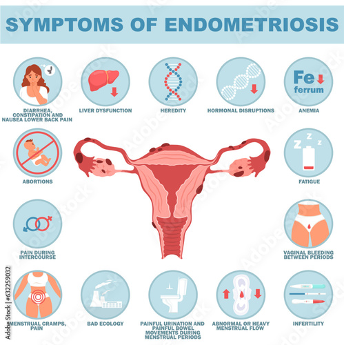Symptom of endometriosis reproductive disease vector illustration