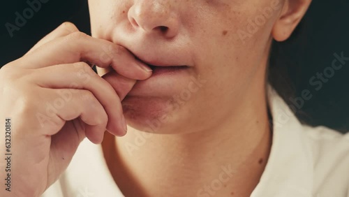 Woman gnaws her nails. Nervous tick. Obsessive-compulsive disorders. Patient of a psychiatric clinic biting lips, scratch face, biting nails, eye twitching. Close up, macro.  photo