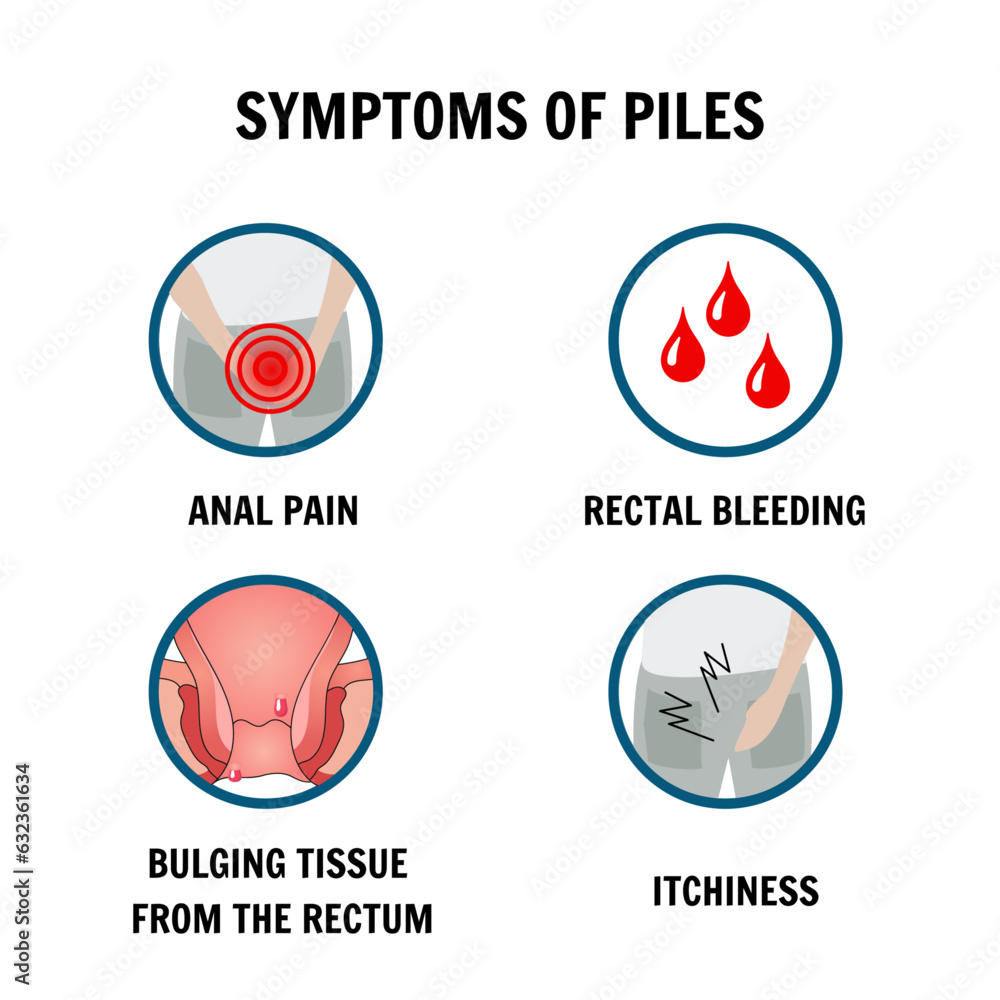 Symptoms of piles hemorrhoids in vector Symptoms of piles hemorrhoids in vector