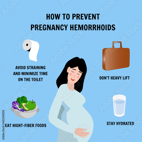 How to prevent pregnancy hemorrhoids medical illustration in vector