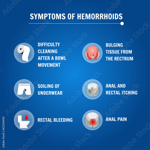 Medical information on external and internal hemorrhoids in vector