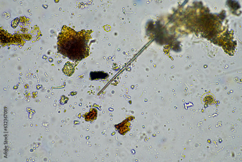 fungal hyphae on a soil sample on a farm. fungi storing carbon in the soil