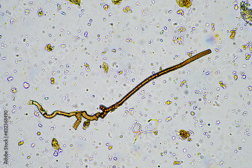 fungal hyphae on a soil sample on a farm. fungi storing carbon in the soil photo