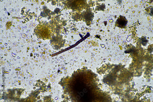 fungal hyphae on a soil sample on a farm. fungi storing carbon in the soil photo