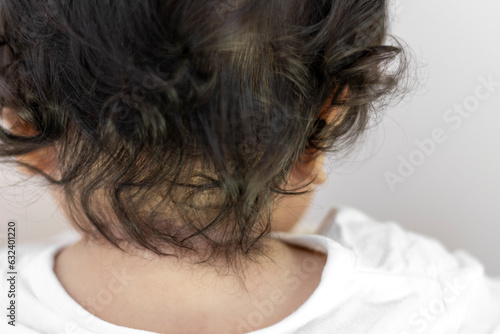 赤ちゃんのくせ毛（男の子、日本人、0歳）