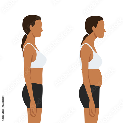 Young woman with bad posture. Spine. Profile.