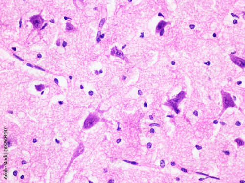 Histology of Human Brain Tissue Viewed at 400x Magnification with Haemotoxylin and Eosin Staining.