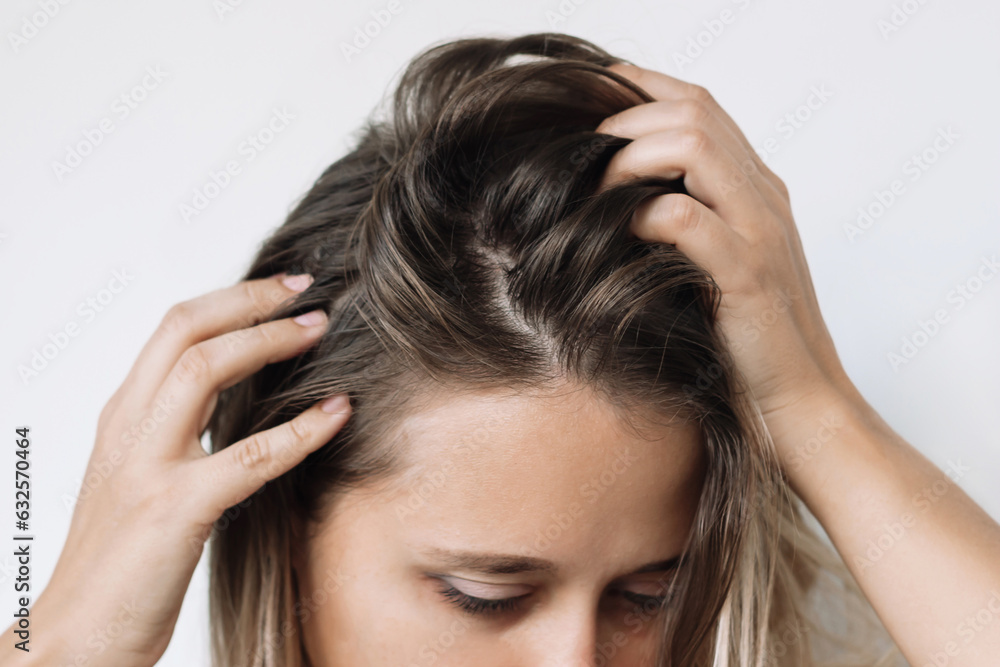 Cropped shot of a young caucasian blonde woman with dirty greasy hair on a white background. The problem of oily scalp. Itching of the skin from long non-washes of the head - obrazy, fototapety, plakaty 