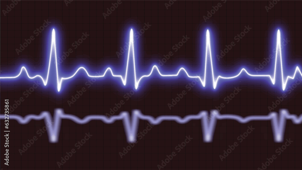 Blue heart monitor line with moving background. Heart rate monitor
