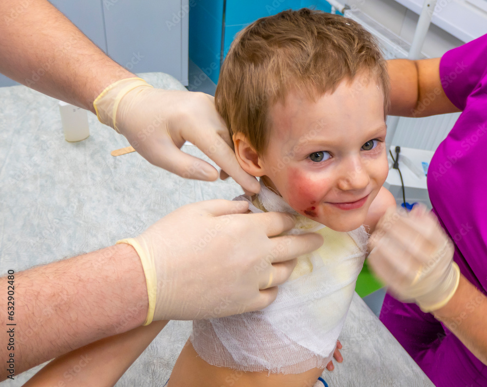 medical procedure dressing a boy with a first-degree burn from boiling water on his face, neck and chest