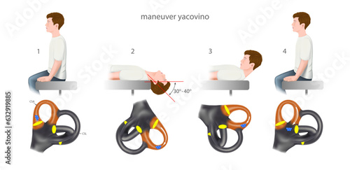 maneuver yacovino