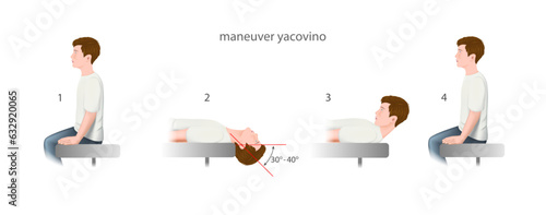 yacovino maneuver