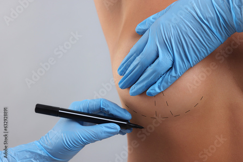 Fotografie Breast augmentation
