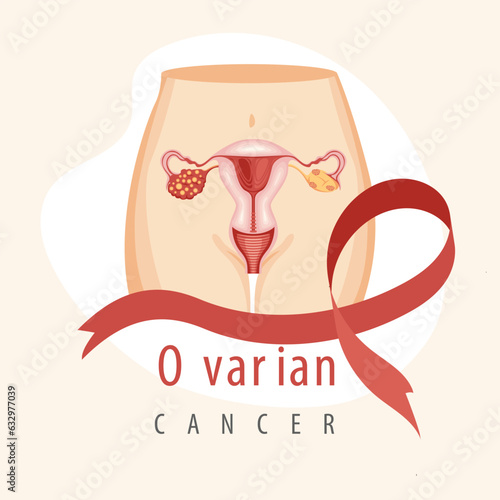 Ovarian Cancer Awareness Illustrration
