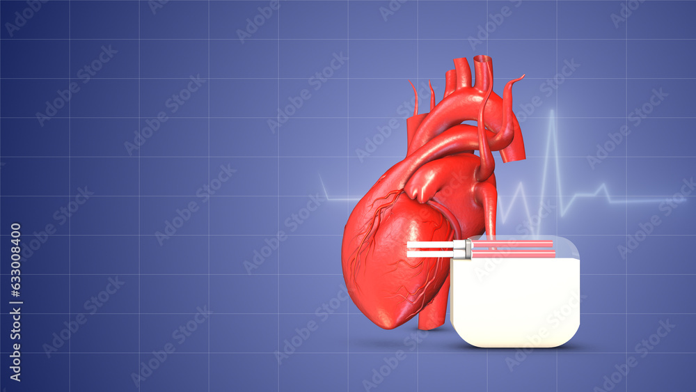 Cardiac pacemaker heartbeat wave insert - obrazy, fototapety, plakaty 