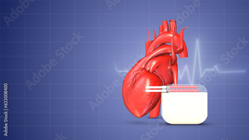 Cardiac pacemaker heartbeat wave insert