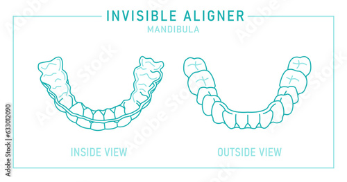 Orthodontic silicone trainer. Invisible braces aligner, retainer.